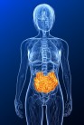 Entstehung Morbus Crohn